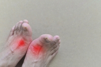 What Can Cause Gout?